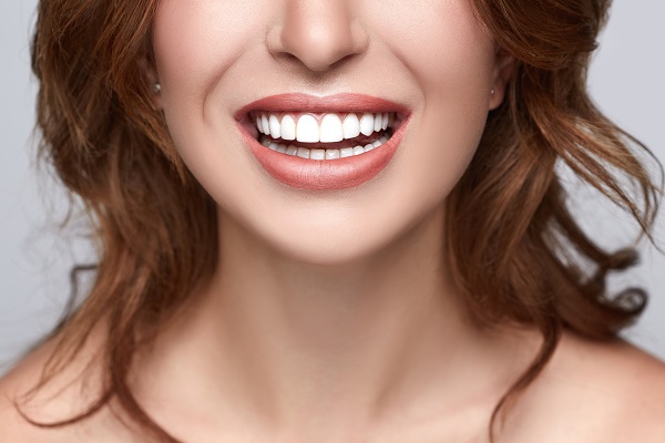 Questions To Ask When Considering A Smile Makeover