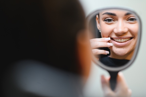 Clear Braces Vs Aligners: Important Differences To Keep In Mind