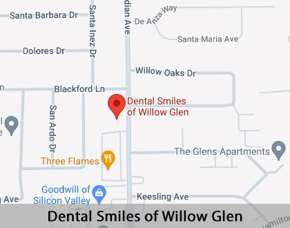 Map image for Implant Dentist in San Jose, CA
