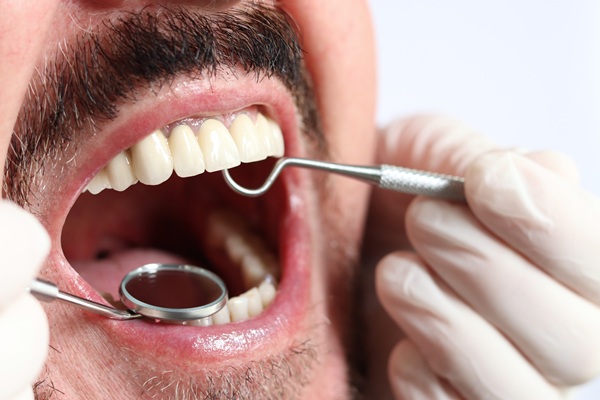 Preventive Dental Care Reduces The Risk Of Contracting Oral Health Conditions